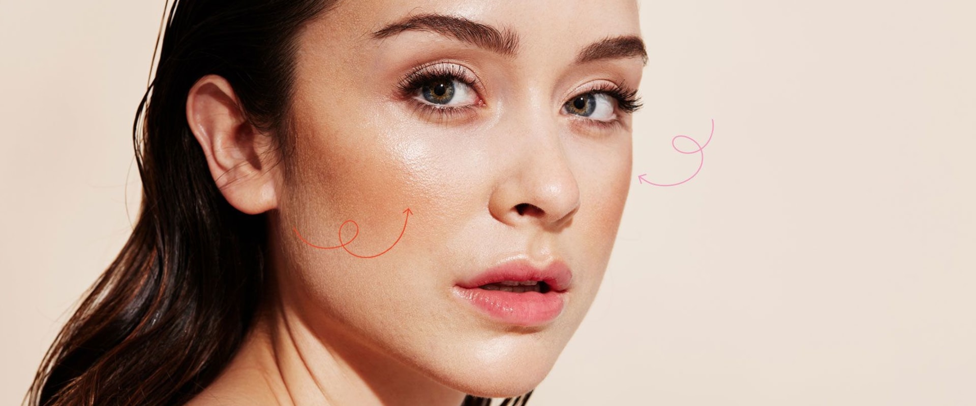 Why Cheek Fillers are So Popular