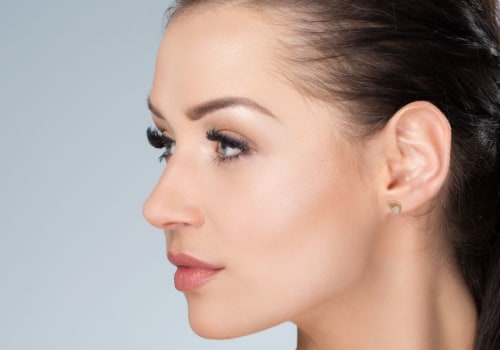 How to Reduce Puffiness After Facial Fillers