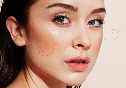 Why Cheek Fillers are So Popular